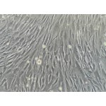 Human Dermal Fibroblasts-neonatal (HDF-n)